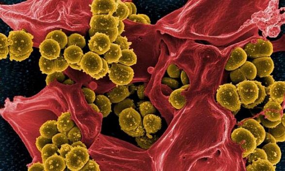 Staphylococcus aureus ca cauză a prostatitei bacteriene